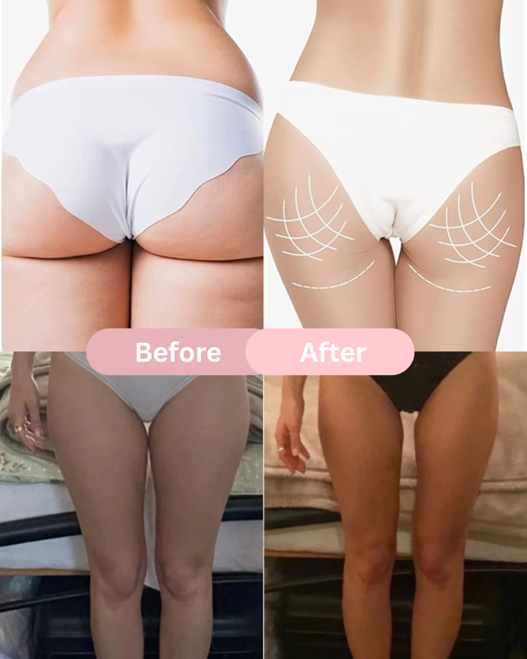Lunaello™ Pelvic & Thigh Trainer