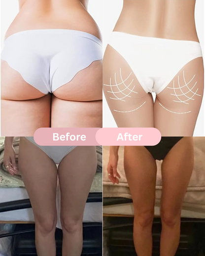 Lunaello™ Pelvic & Thigh Trainer